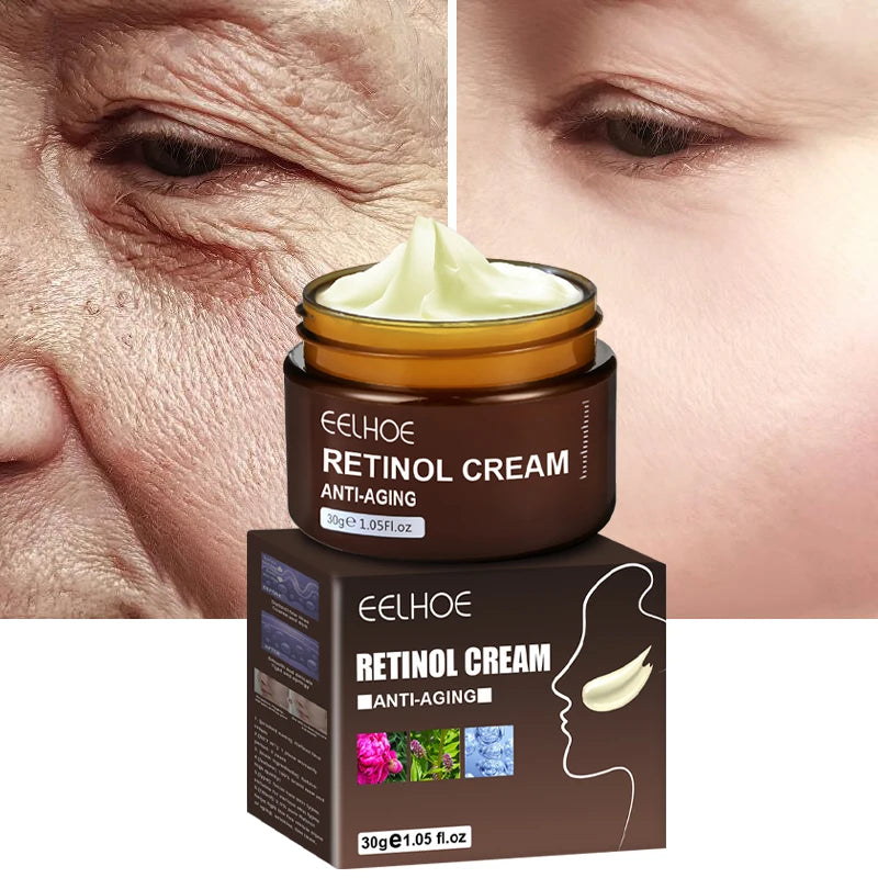 Retinolový krém proti starnutiu